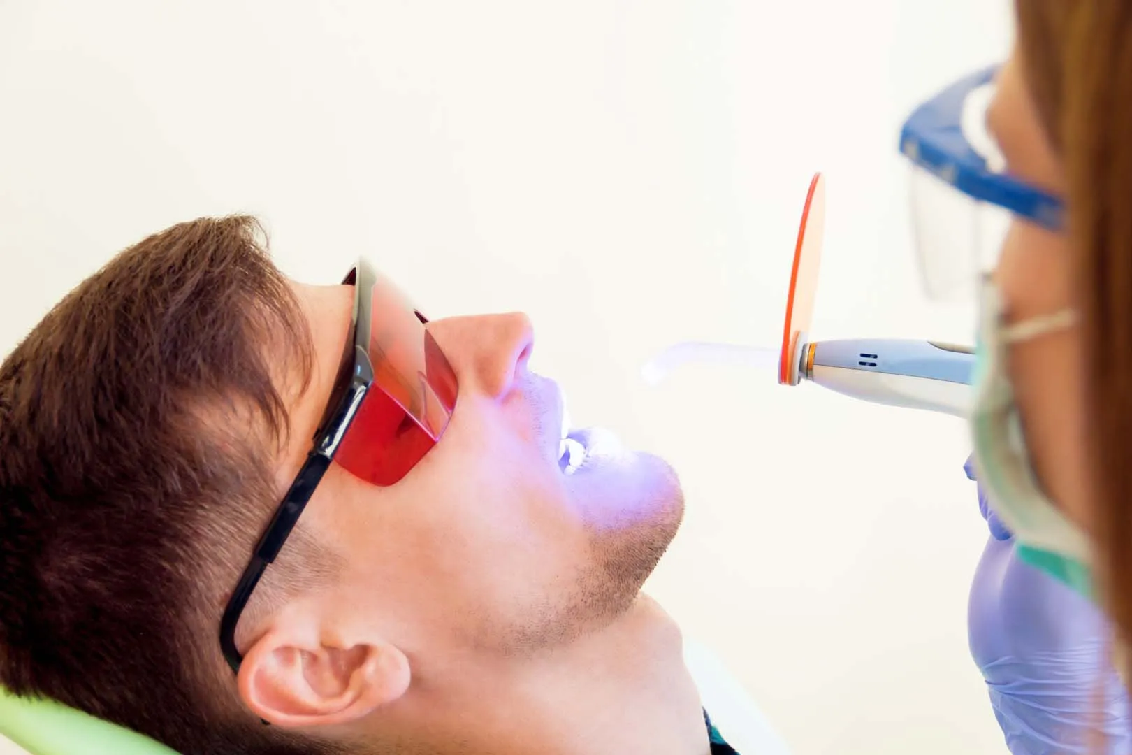 Dental sealant application