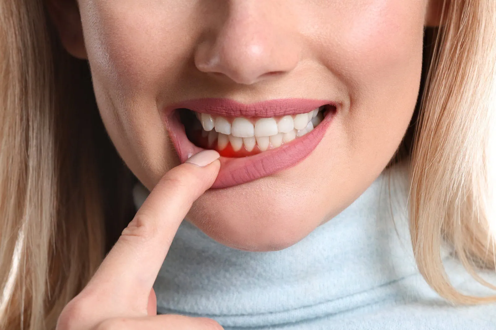 Advanced therapy gum treatment