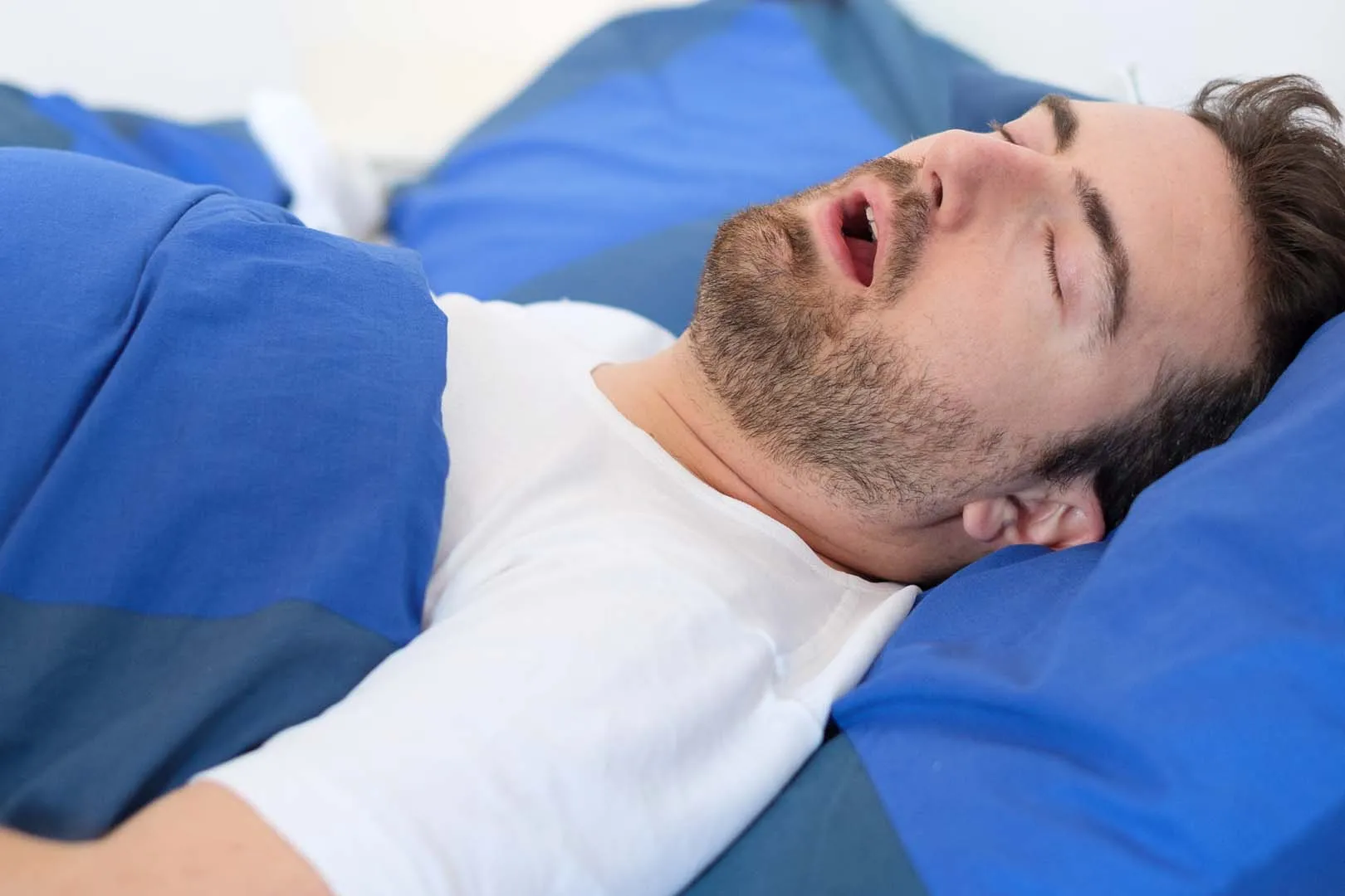 Sleep apnea treatment