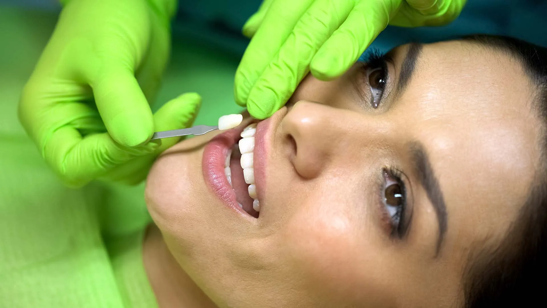 Smile makeover consultation